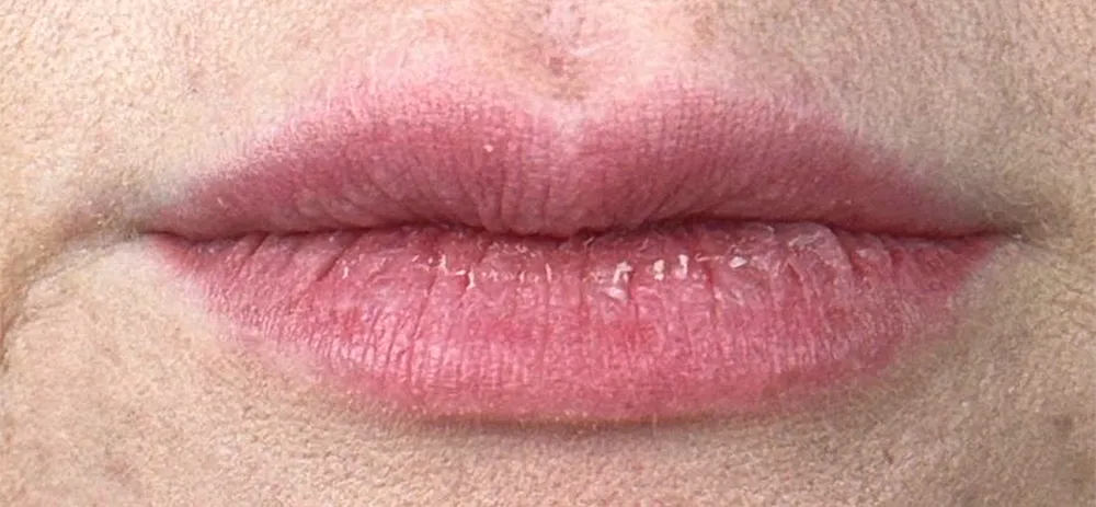 Lábios ressecados e sem brilho antes do Lip Gloss