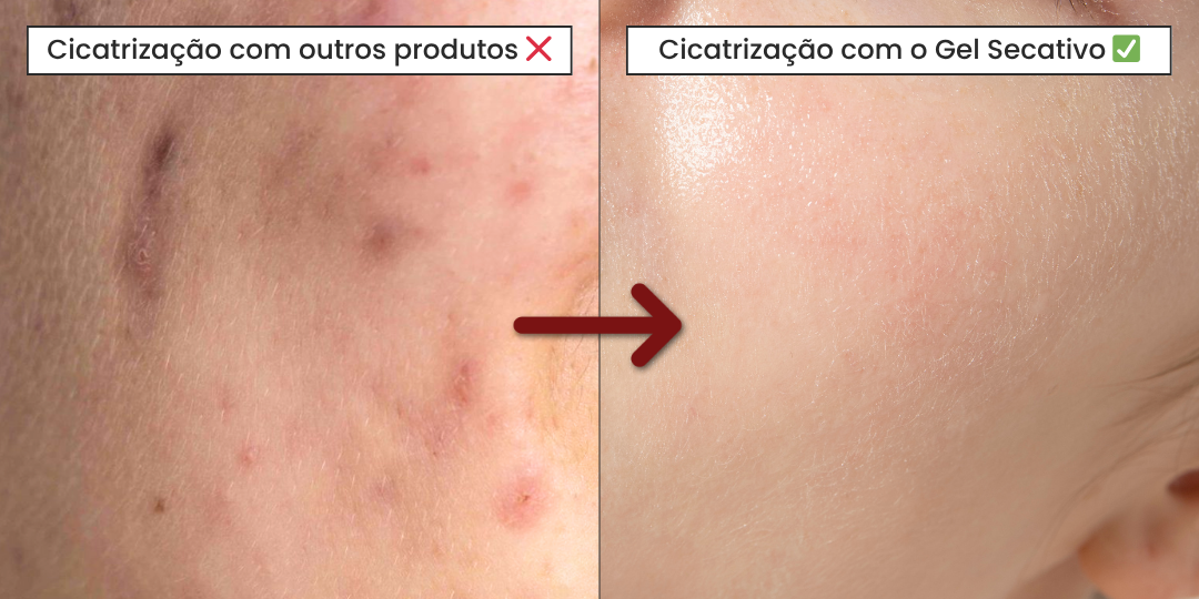 Cicatrização.png__PID:b55caa2a-9a81-447f-9290-c142dac7af97